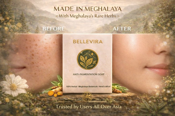 Anti-Pigmentation Soap