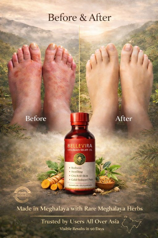 Chilblain Relief Oil