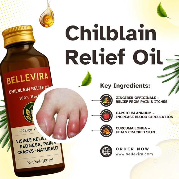 Chilblain Relief Oil
